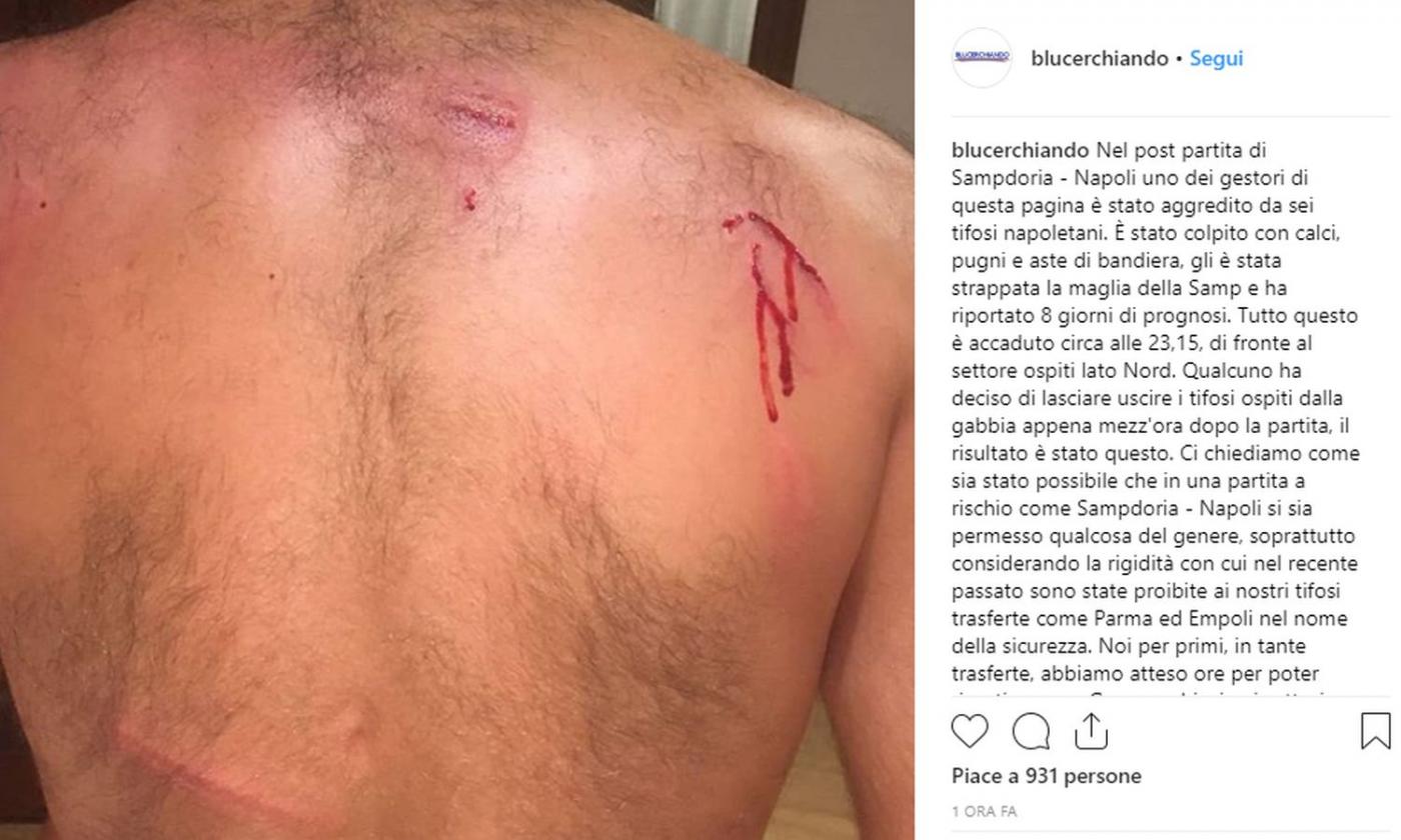 Tifoso Della Samp Pestato Da Un Gruppo Di Sostenitori Del Napoli Foto