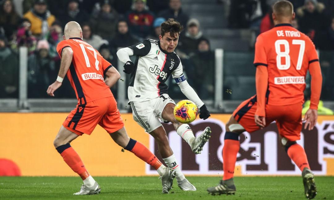 La Juve celebra l'azione Dybala-Higuain: 'A noi sembra arte' FOTO