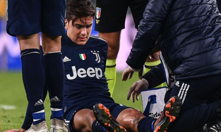 Juve, Dybala da 'infortunio facile' anche nei videogiochi