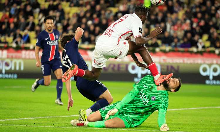 Donnarumma, paura nello scontro di gioco: volto sfigurato FOTO